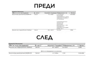 снимка на изследванията на Дарина, клиентка на MavrovFit тип преди и след. След правилно хранене при инсулинова резистентност и сваляне на 35кг има огромна разлика в стойностите на инсулина преди и след това.