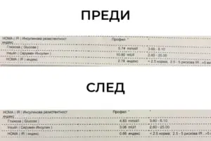 снимка тип преди и след на Силвия, клиент на MavrovFit, която беше слаба и с нарушен глюкозен метаболизъм. След 3 месеца тренировки и правилно хранене при инсулинова резистентност, тя подобри и вкара стойностите си в норми.